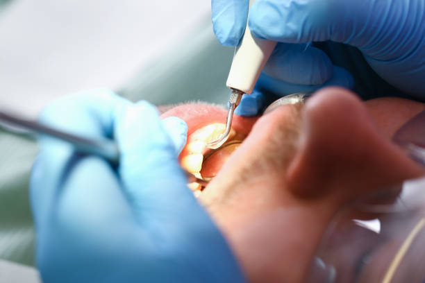 Best After-Hours Emergency Dentist in Roanoke, IL