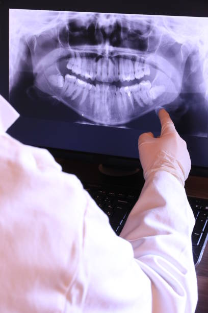 Best Emergency Tooth Extraction in Roanoke, IL