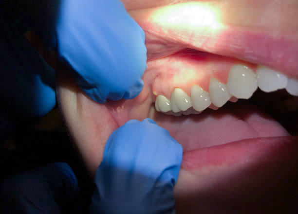 Best Weekend Emergency Dentist in Roanoke, IL